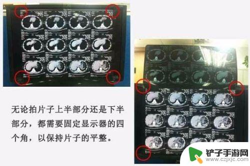 手机上怎样查医院ct片子 手机拍照医院检查影像片子步骤