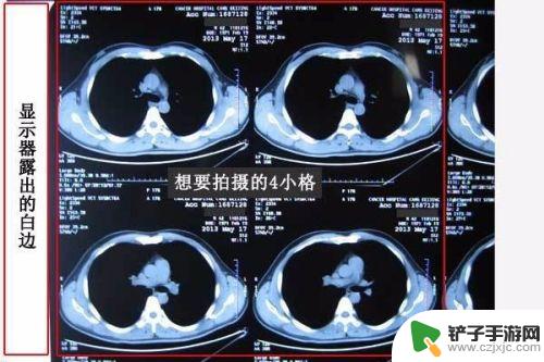 手机上怎样查医院ct片子 手机拍照医院检查影像片子步骤